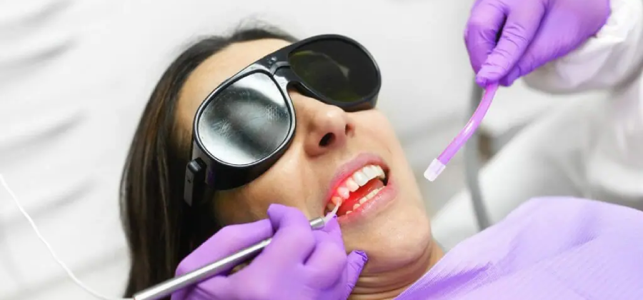 سفید کردن دندان با لیزر دندانپزشکی